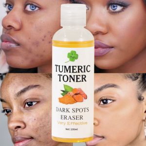 Dark Spots Eraser Turmeric Toner Cross border Blackening Turmeric Toner