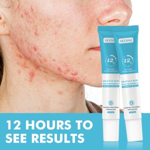 Salicylic acid acne cream fades acne scars, removes blackheads and closed comedones, shrinks pores; plant essence acne gel.