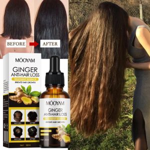 Ginger Hair Nourishing Lotion Nourishing Hair Follicles, Removing dandruff, Nourishing Hair Roots, Hair Securing Lotion, Herbal essence Ginger Hair Conditioner